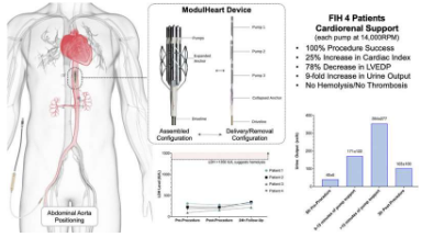 研究发现机械循环支持和肾脏灌注成功与ModulHeart装置