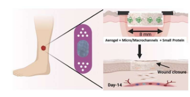 含有小蛋白质分子的微通道纳米纤维气凝胶可加速糖尿病伤口愈合