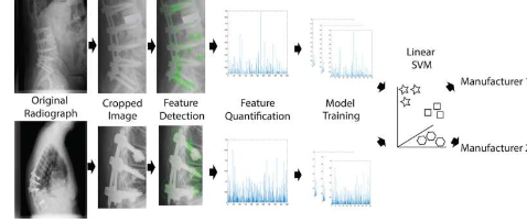 研究表明计算机视觉在识别脊柱植入物方面优于外科医生