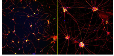 成熟的实验室培养神经元有望治疗神经退行性疾病