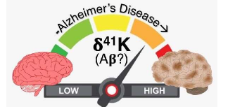 研究人员发现大脑中钾耗竭部位会积聚β淀粉样蛋白