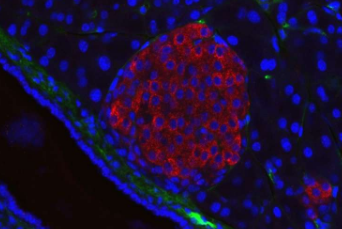 研究确定了与2型糖尿病相关的人类microRNA