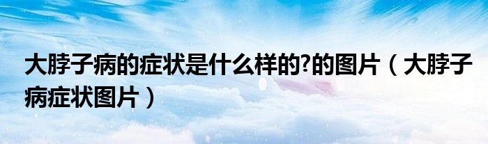 大脖子病的症状是什么样的?的图片（大脖子病症状图片）