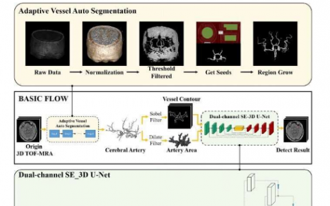 研究人员提出未破裂脑动脉瘤的自动化检测方法