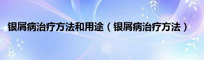 银屑病治疗方法和用途（银屑病治疗方法）