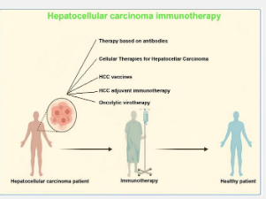免疫疗法治疗肝细胞癌的治疗选择