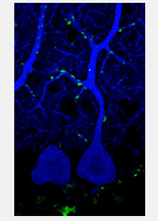 科学家发现小脑突触形成的决定机制